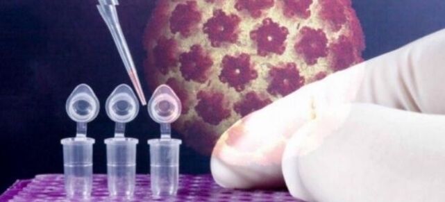 Diagnóstico de HPV com o teste Digene